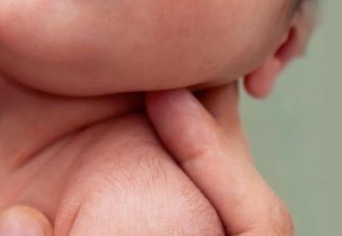 skóra atopowa u niemowlaka kosmetyki La Roche-Posay