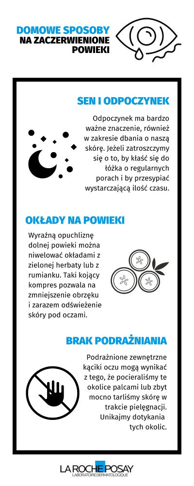 Domowe sposoby na zaczerwienione powieki - infografika | La Roche-Posay