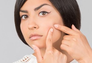 nawilżanie skóry trądzikowej - Sucha skóra z trądzikiem – jak nawilżyć skórę? | La Roche-Posay