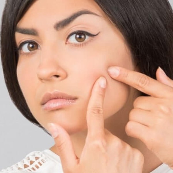 nawilżanie skóry trądzikowej | Sucha skóra z trądzikiem - jak nawilżyć skórę? - La Roche-Posay