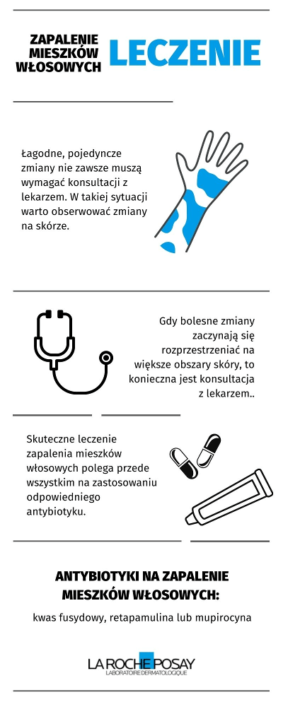 Zapalenie mieszków włosowych - leczenie - infografika | La Roche-Posay