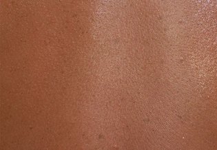 Alergiczna Alergia skórna skóra wrażliwa i | La Roche Posay