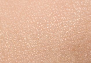 Uszkodzona Jak pielęgnować skórę po | La Roche Posay 1