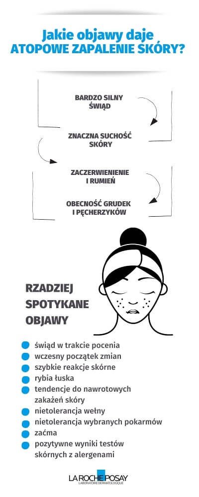 Jakie objawy daje atopowe zapalenie skóry - infografika | La Roche-Posay