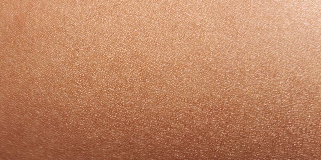 Egzema Sucha skóra aEgzema | La Roche Posay 1