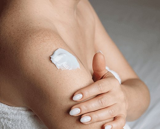 Kobieta aplikuje krem na podrażnienia skóry na objawy pokrzywki cieplnej