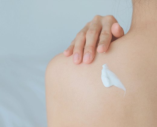 Kobieta aplikuje krem na rogowacenie okołomieszkowe na ramionach