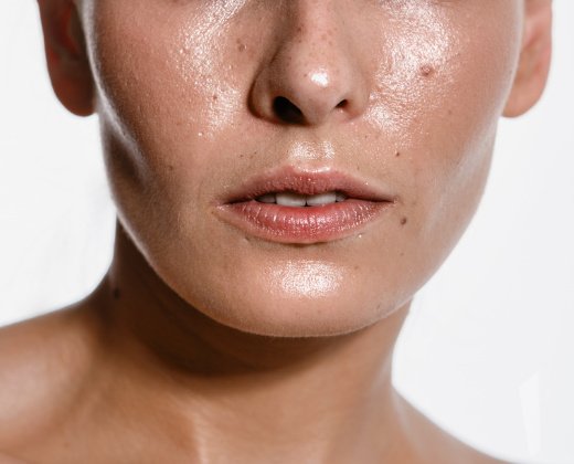 Widoczny nadmiar sebum na twarzy