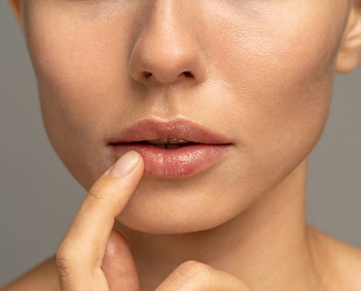 Kobieta aplikuje balsam na suche usta