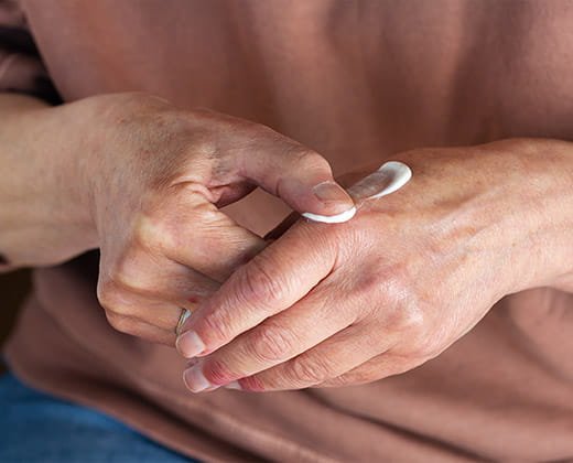 Pielęgnacja skóry dłoni przy wyprysku kontaktowym