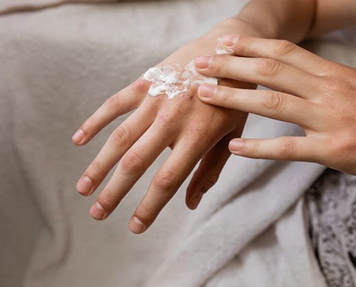 Pielęgnacja skóry dłoni z wypryskiem potnicowym