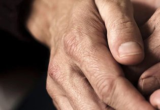 Plamy starcze | 3 sposoby na starcze plamy na dłoniach - La Roche-Posay