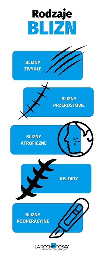  Rodzaje blizn, sprawdź jak się ich pozbyć