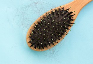 Wrażliwa Wypadanie włosów | La Roche Posay 3