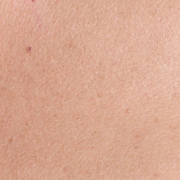 Nadwrażliwość skóry na dotyk | Reaktywność skóry: 3 przyczyny posiadania skóry wrażliwej - La Roche-Posay