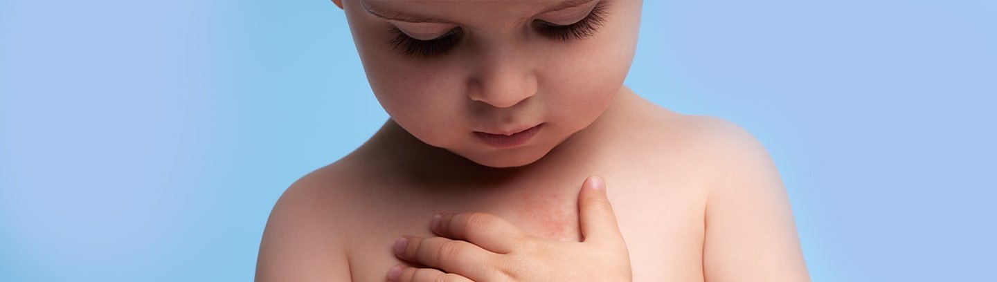 Zdjęcie matki z córką w artykule o egzemie na stronie marki La Roche-Posay