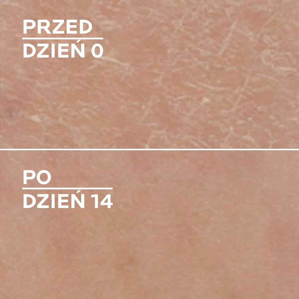 Lipikar Urea 10 od La Roche-Posay 