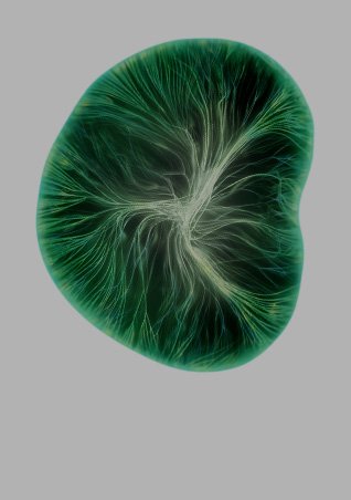 /-/media/project/loreal/brand-sites/lrp/emea/pl/simple-page/landing-page/hyalu-b5-serum-kwas-hialuronowy/hyalu-b5-lp-skladnik-3.jpg