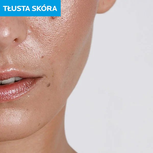Tłusta skóra